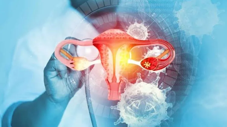 Científicos colombianos desarrollan alternativa para detectar el cáncer de cuello uterino