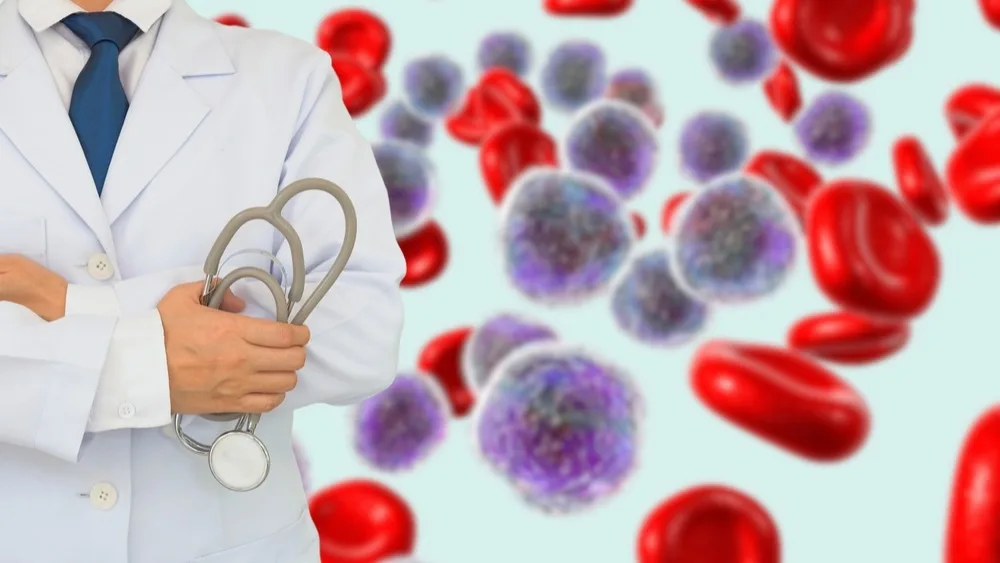 ¿Qué es la leucemia mieloide aguda? la primera con más casos nuevos cada año