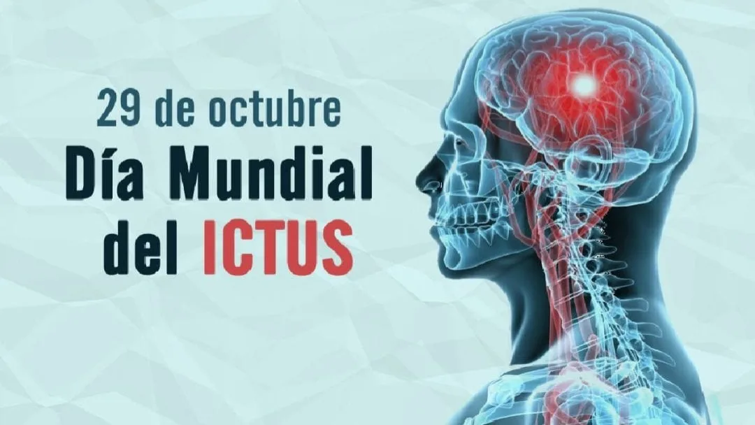 Día Mundial del Ictus: reconoce las señales de alerta, actuar a tiempo puede salvar vidas