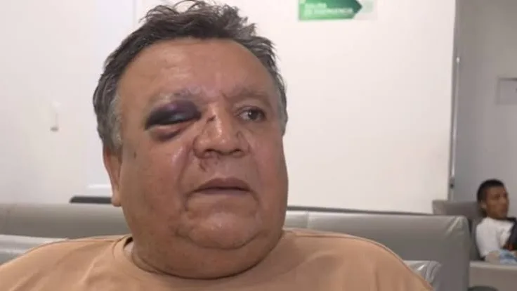 Habló el conductor del bus accidentado en la vía Panamericana tras presunto ataque armado: