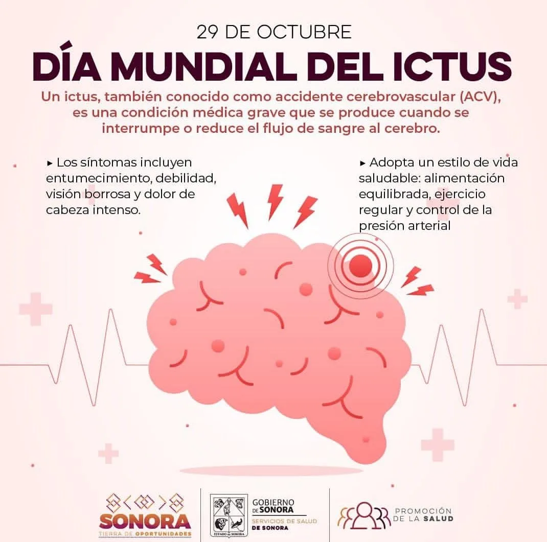 Ictus