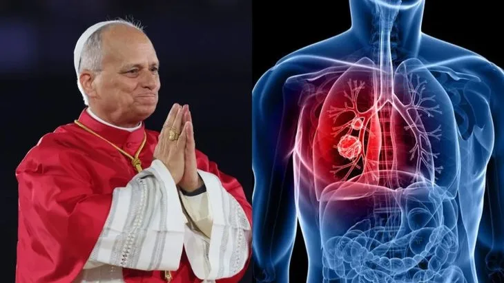 Papa León XIV fue operado por cáncer de pulmón: síntomas y tratamiento