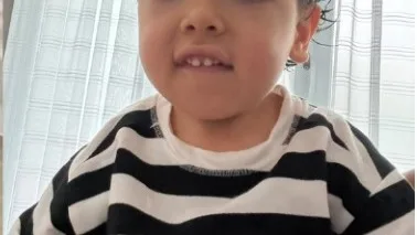 Niño sigue en espera de su corsé