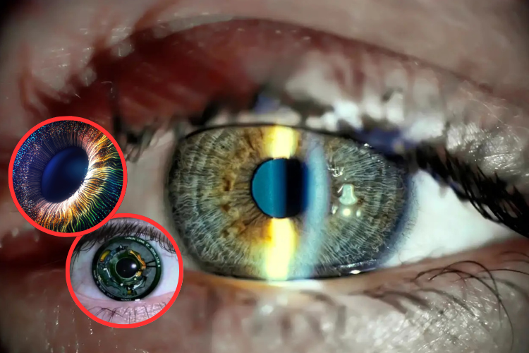 Implante ocular revolucionario devuelve la visión a personas con ceguera