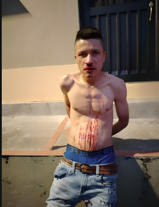 Lo agredió con cuchillo