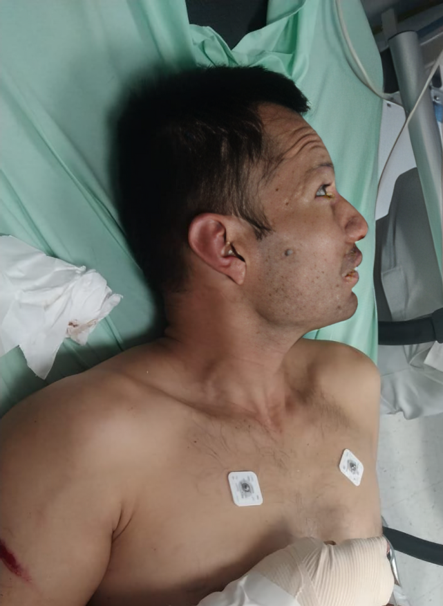 Oro en la Inclusión