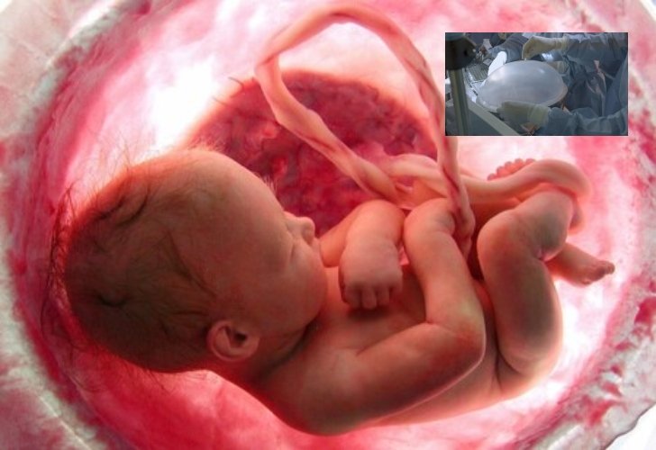 Científicos crean útero artificial para salvar a bebés prematuros extremos