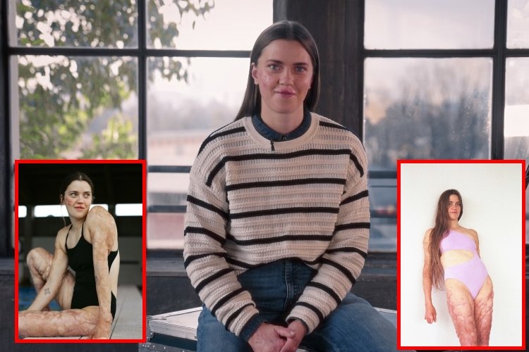 Veronica Yoko Plebani: la atleta que transformó sus cicatrices en un símbolo de belleza e inclusión