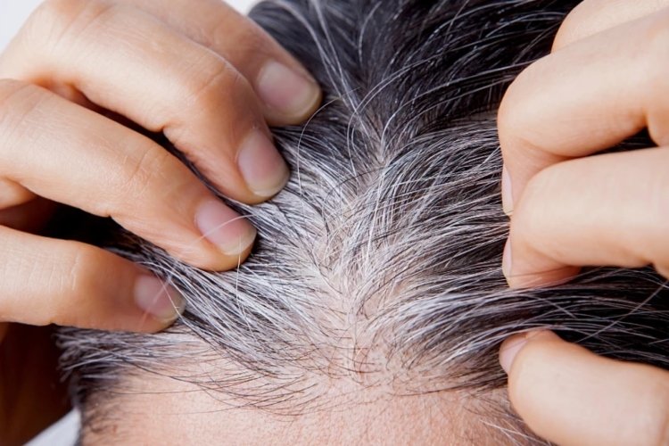 ¿Arrancarse las canas? Esto dice un dermatólogo