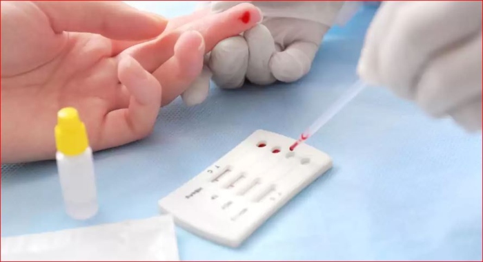 Prueba VIH- SIDA- PREVENCIÓN- GSK-