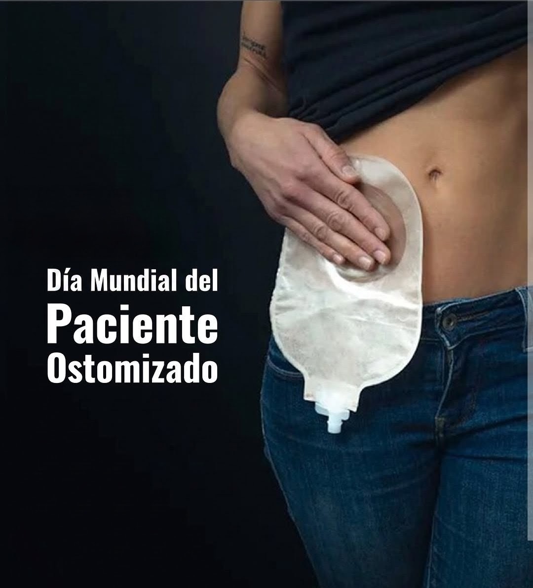 Vivir con una ostomía implica adaptarse a una nueva realidad, pero no renunciar a una vida plena.